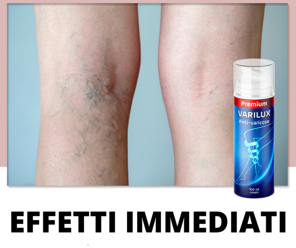 Progetto-senza-titolo-1.png