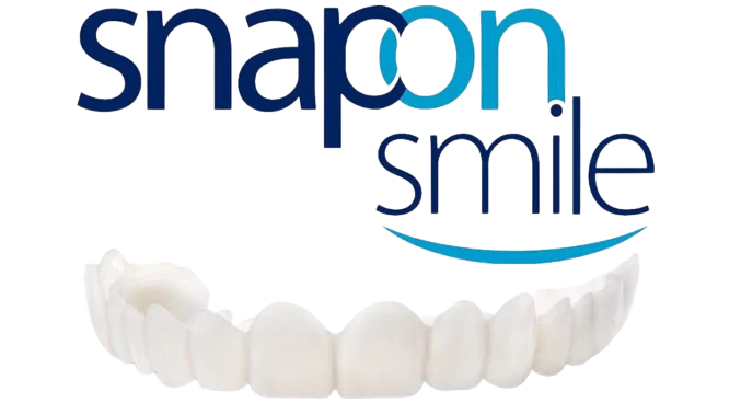 Snap On Smile vista frontale e posteriore